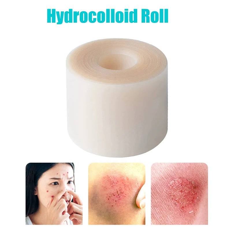 Hydrocolloid Roll Wound Care Pimple
